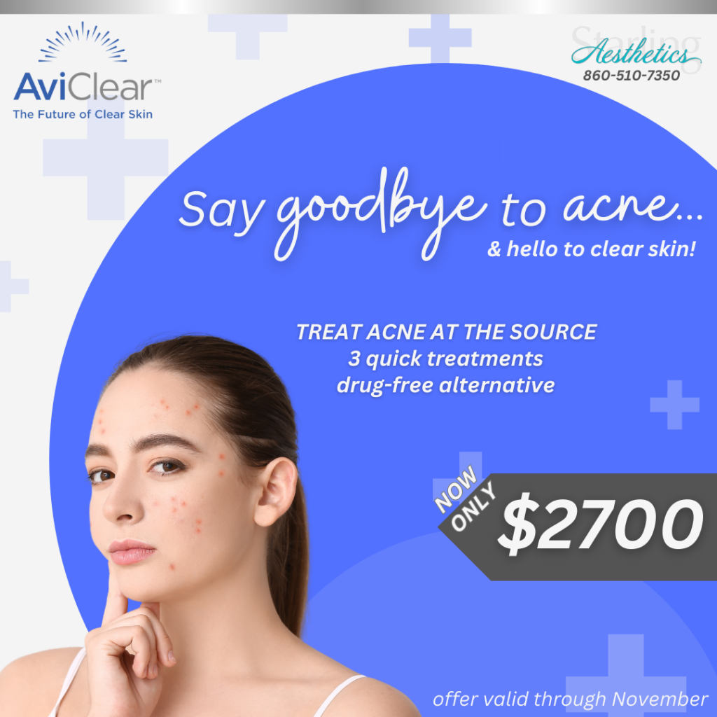 Say goodbye to Acne